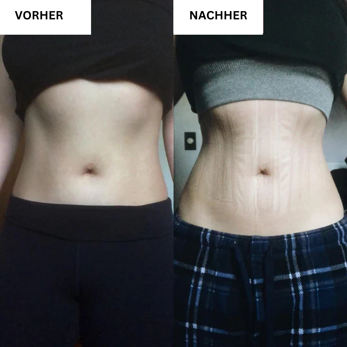 Waistly | Taillentrainer